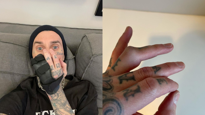 Travis Barker (Foto: Reprodução/Instagram)