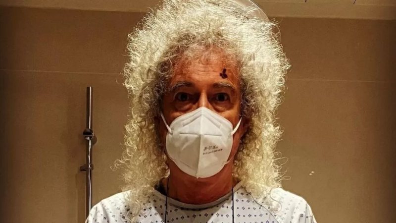 Brian May em foto antes da cirurgia no olho (Foto: Reprodução/Instagram/@brianmayforreal)