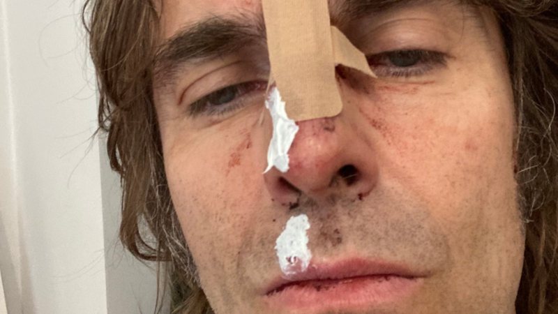 Liam Gallagher (Foto: Reprodução/Twitter)