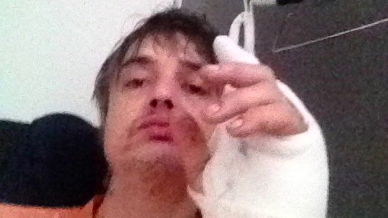 Pete Doherty publicou uma imagem sobre sua hospitalização (Foto: Twitter / Reprodução)