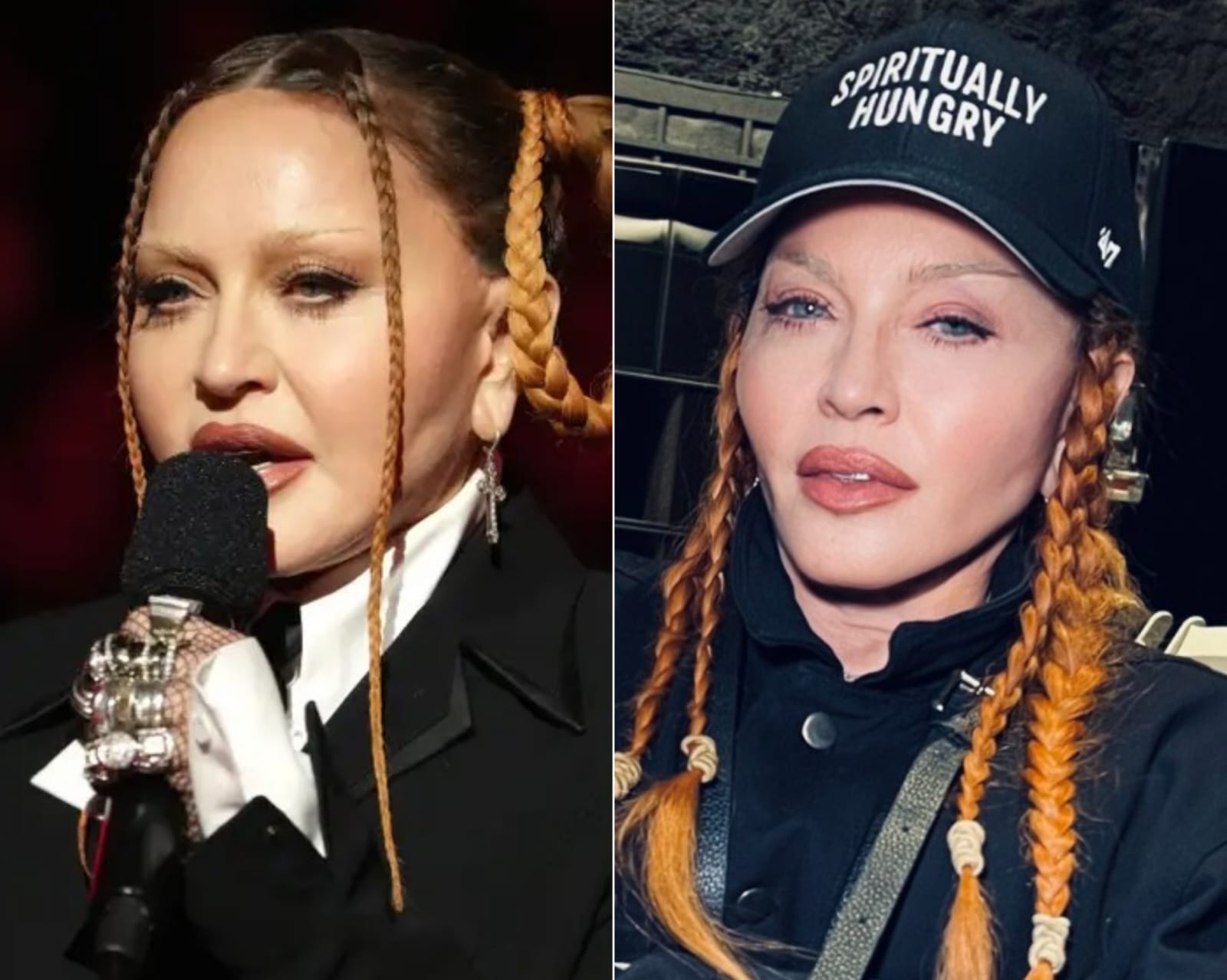 Madonna no Grammy 2023 e em novo post nas redes sociais: 'inchaço passou' (Getty Images/Reprodução)