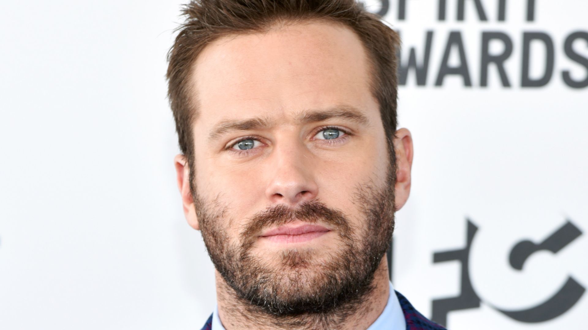 Armie Hammer diz que tentou ficar com homens, porque 'mulheres são as piores'