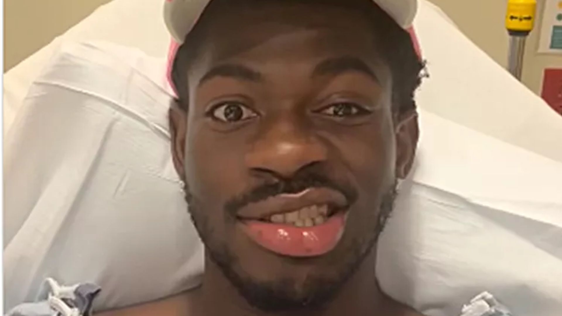 Lil Nas X disse que perdeu "controle do lado direito do rosto"