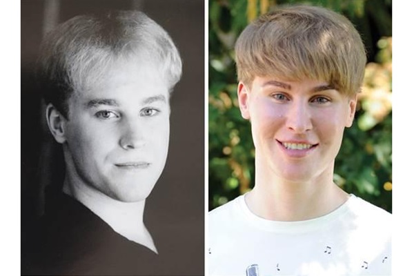 Tobias Strebel antes e depois dos procedimentos para se parecer com Justin Bieber