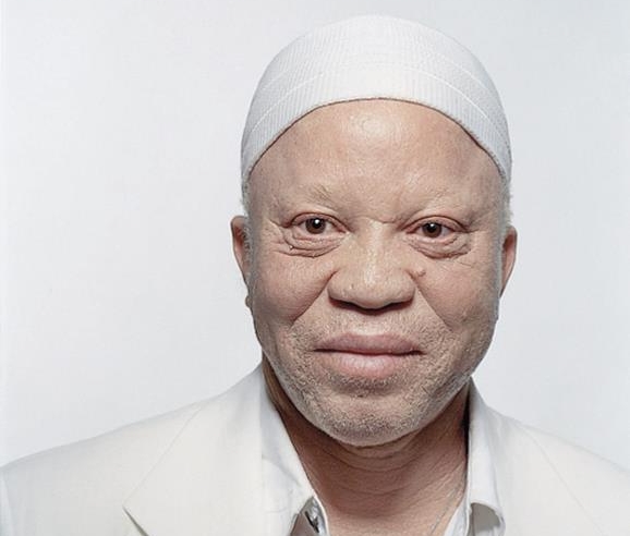 O músico africano Salif Keita